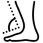 Paediatric stroke rehabilitation London